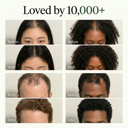 Korean Scalp Revival Bar