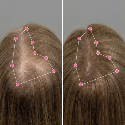 Korean Scalp Revival Bar Vid